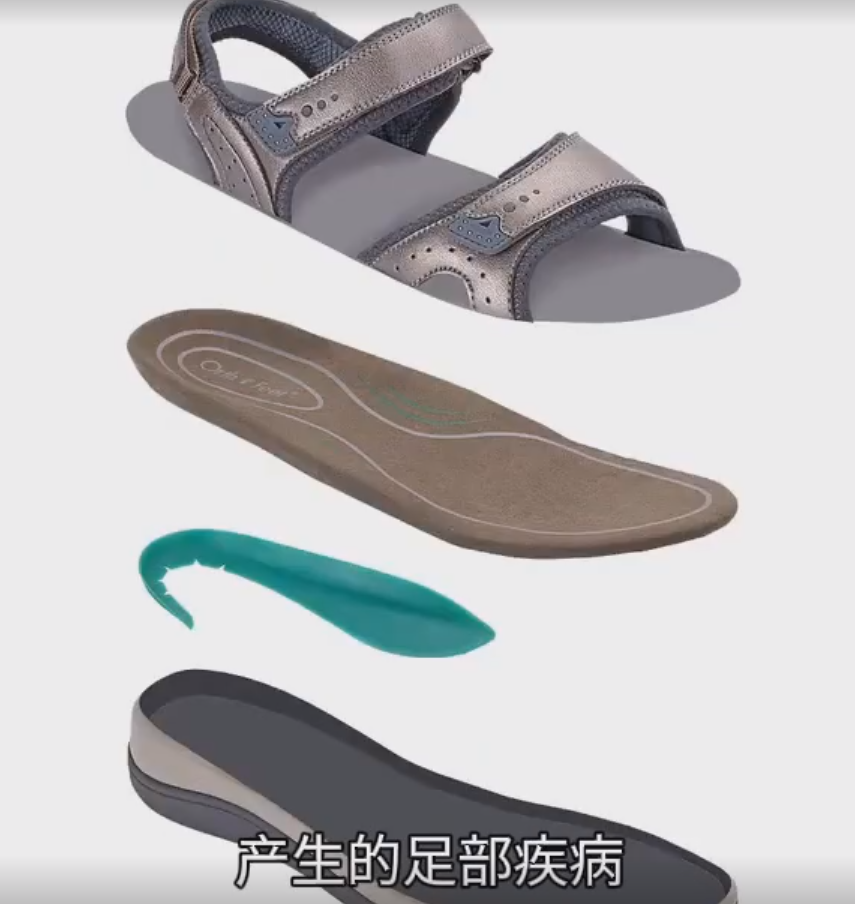 定制轻量化矫形鞋垫-拓扑优化与3D打印的完美结合